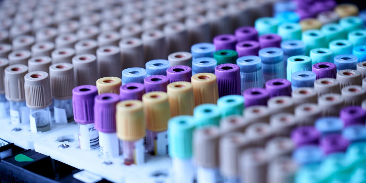 Blood Samples